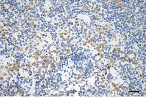 Immunohistochemistry was performed on paraffin-embedded mouse spleen using P70 S6 kinase beta antibody (ABIN7800226), 1:200).