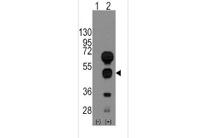 Western blot analysis of GATA4 (arrow) using rabbit polyclonal GATA4 Antibody (C-term) (ABIN388153 and ABIN2846917). (GATA4 antibody  (C-Term))