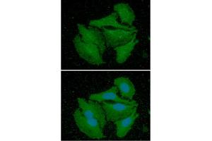 ICC/IF analysis of CALB2 in HeLa cells line, stained with DAPI (Blue) for nucleus staining and monoclonal anti-human CALB2 antibody (1:100) with goat anti-mouse IgG-Alexa fluor 488 conjugate (Green). (Calretinin antibody  (AA 1-271))
