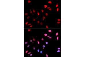 Immunofluorescence analysis of GFP-RNF168 trangenic U2OS cell using RAD18 antibody. (RAD18 antibody)