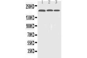 Anti-EGFR Picoband antibody,  All lanes: Anti-EGFR at 0.