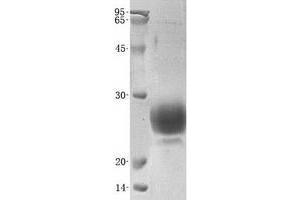 Validation with Western Blot (WFDC2 Protein (His tag))
