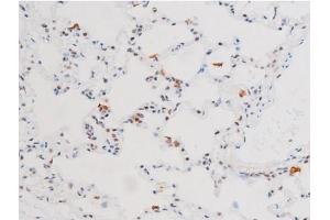 ABIN6267602 at 1/200 staining Rat lung tissue sections by IHC-P. (NF-kB p65 antibody  (pSer281))