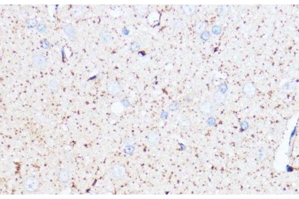 Monoamine Oxidase A antibody