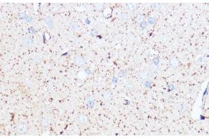 Immunohistochemistry of paraffin-embedded Rat brain using MAOA Polyclonal Antibody at dilution of 1:100 (40x lens). (Monoamine Oxidase A antibody)