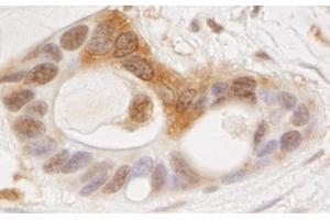 anti-Odd-Skipped Related 1 (OSR1) (AA 375-425) antibody