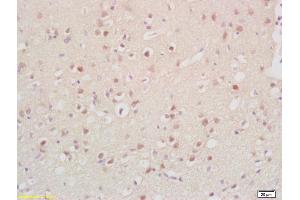 Formalin-fixed and paraffin embedded rat brain labeled with Anti-Cyclin G2 Polyclonal Antibody, Unconjugated (ABIN704621) at 1:200, followed by conjugation to the secondary antibody and DAB staining (Cyclin G2 antibody  (AA 151-250))