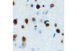 Immunohistochemical analysis of LYL1 staining in human brain formalin fixed paraffin embedded tissue section. (LYL1 antibody  (Center))