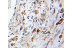 #VALUE! (S100A6 antibody  (AA 1-89))