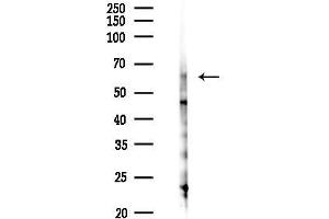 Western blot analysis of lysates from COLO205 cells(heat-shock,45 min treatment), using PPAT Antibody at 1/1000 dilution.