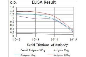 Black line: Control Antigen (100 ng), Purple line: Antigen(10 ng), Blue line: Antigen (50 ng), Red line: Antigen (100 ng), (CBX8 antibody  (AA 17-222))