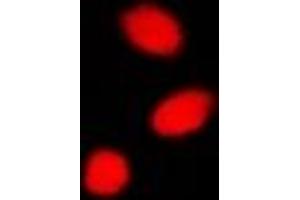 Immunofluorescent analysis of CBX4 staining in A549 cells. (CBX4 antibody)