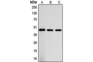 Western blot analysis of ARRDC3 expression in Jurkat (A), mouse liver (B), rat liver (C) whole cell lysates. (ARRDC3 antibody  (C-Term))