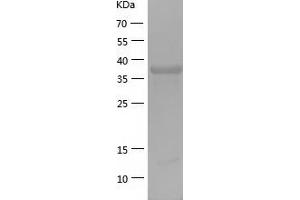 Western Blotting (WB) image for RAB3A Interacting Protein (Rabin3)-Like 1 (RAB3IL1) (AA 1-382) protein (His tag) (ABIN7124754) (RAB3IL1 Protein (AA 1-382) (His tag))