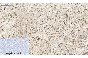 Immunohistochemical analysis of paraffin-embedded human uterus tissue. (CXCL12 antibody  (C-Term))