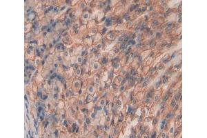 Used in DAB staining on fromalin fixed paraffin- embedded Kidney tissue (SHISA4 antibody  (AA 28-197))