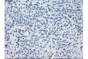 Immunohistochemical staining of paraffin-embedded endometrium tissue using anti-FCGR2A mouse monoclonal antibody. (FCGR2A antibody)