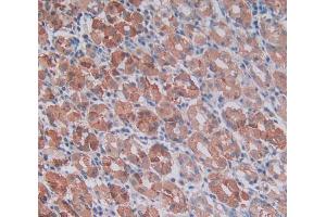 Used in DAB staining on fromalin fixed paraffin- embedded stomach tissue (MMP14 antibody  (AA 322-541))