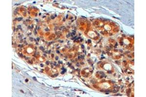 WNT3 polyclonal antibody (Cat # PAB7032, 2 ug/mL) staining of paraffin embedded human breast. (WNT3 antibody  (Internal Region))