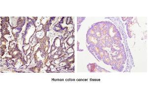 Immunohistochemistry (IHC) image for anti-Acyl-CoA Thioesterase 11 (ACOT11) (AA 19-250) antibody (ABIN317516) (ACOT11 antibody  (AA 19-250))