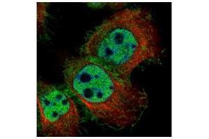 ICC/IF Image Confocal immunofluorescence analysis (Olympus FV10i) of paraformaldehyde-fixed A431, using LYN, antibody (Green) at 1:500 dilution. (LYN antibody  (Center))