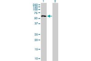 Western Blot analysis of ST8SIA2 expression in transfected 293T cell line by ST8SIA2 MaxPab polyclonal antibody. (ST8SIA2 antibody  (AA 1-354))