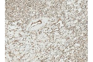 Immunohistochemistry analysis using Rabbit Anti-TCF4 Polyclonal Antibody (ABIN5650930). (TCF4 antibody  (AA 500-600) (FITC))