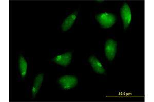 Immunofluorescence of purified MaxPab antibody to TTK on HeLa cell. (Mps1 antibody  (AA 1-857))