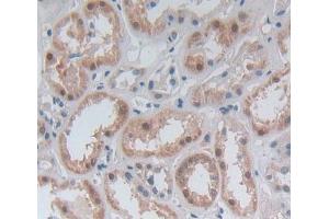 Used in DAB staining on fromalin fixed paraffin- embedded Kidney tissue (GBP4 antibody  (AA 1-292))