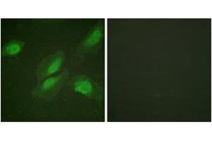 Immunofluorescence (IF) image for anti-V-Akt Murine Thymoma Viral Oncogene Homolog 1 (AKT1) (AA 292-341) antibody (ABIN2888779) (AKT1 antibody  (AA 292-341))
