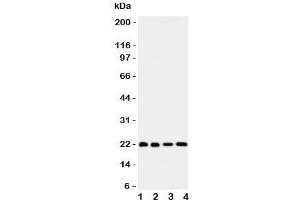 Western blot testing of Bid antibody and Lane 1:  HeLa;  2: COLO320;  3: Jurkat;  4: SKOV lysate.