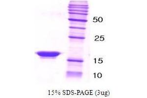 Figure annotation denotes ug of protein loaded and % gel used. (beta Synuclein Protein)