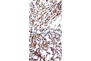 A : Immunohistochemical analysis of CD79A expression in paraffin fixed mouse inguinal lymphoma tissue. (CD79a antibody)