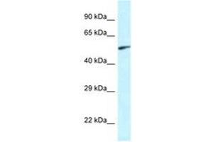 Image no. 1 for anti-Eyes Absent Homolog 2 (Drosophila) (EYA2) (AA 200-249) antibody (ABIN6747418) (EYA2 antibody  (AA 200-249))