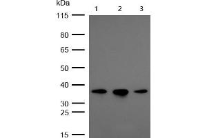 All lanes : OXGR1 Rabbit mAb at 1/1k dilution Lane 1 : Hela whole cell lysates Lane 2 : A549 whole cell lysates Lane 3 : HUVEC whole cell lysates Lysates/proteins at 20 μg per lane. (Recombinant OXGR1 antibody)