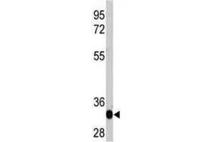 Western blot analysis of recombinant protein with LIN28A antibody (LIN28A antibody)