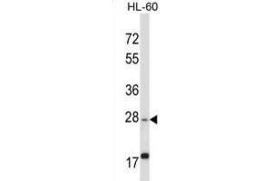 Western Blotting (WB) image for anti-Apolipoprotein O-Like (APOOL) antibody (ABIN2997795) (APOOL antibody)