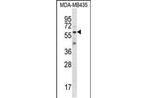 Western blot analysis in MDA-MB435 cell line lysates (35ug/lane). (Fascin 3 antibody  (C-Term))
