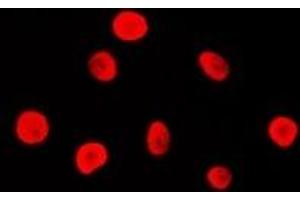 Immunofluorescent analysis of MSH2 staining in Hela cells. (MSH2 antibody)