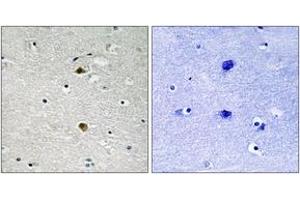 Immunohistochemistry analysis of paraffin-embedded human brain tissue, using NF-kappaB p65 (Ab-281) Antibody. (NF-kB p65 antibody  (AA 247-296))