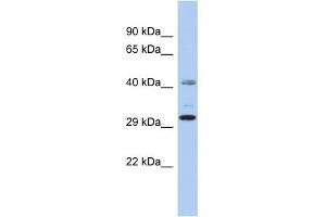 C11orf46 antibody  (N-Term)