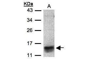 WB Image Sample(30 μg of whole cell lysate) A:MOLT4, 15% SDS PAGE antibody diluted at 1:500 (CCL1 antibody  (C-Term))