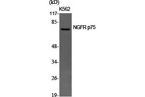 Western Blotting (WB) image for anti-Nerve Growth Factor Receptor (NGFR) (Internal Region) antibody (ABIN5956122) (NGFR antibody  (Internal Region))