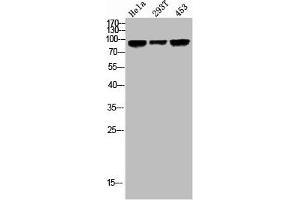 Western Blot analysis of HELA 293T 453 cells using Phospho-GR (S203) Polyclonal Antibody (Glucocorticoid Receptor antibody  (pSer203))