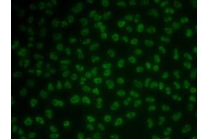 Immunofluorescence analysis of MCF7 cells using KHDRBS3 antibody (ABIN6131841, ABIN6142833, ABIN6142834 and ABIN6222332). (KHDRBS3 antibody  (AA 177-346))