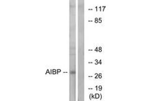 Western blot analysis of extracts from HeLa cells, using AIBP Antibody. (C1orf135 antibody  (AA 121-170))