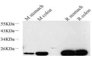Western Blot analysis of various samples using TAGLN Polyclonal Antibody at dilution of 1:600.