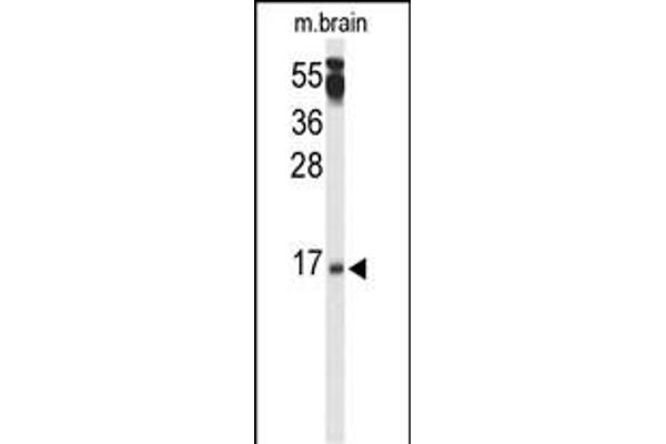 Calcineurin B antibody  (N-Term)