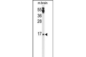 Western blot analysis of P3R2 Antibody (N-term) (ABIN653332 and ABIN2842820) in mouse brain tissue lysates (35 μg/lane). (Calcineurin B antibody  (N-Term))