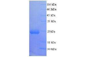 SDS-PAGE (SDS) image for BCL2/adenovirus E1B 19kDa Interacting Protein 3-Like (BNIP3L) (AA 1-219), (full length) protein (His tag) (ABIN5713284) (BNIP3L/NIX Protein (AA 1-219, full length) (His tag))